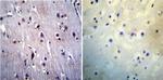 Presenilin 1 Antibody in Immunohistochemistry (Paraffin) (IHC (P))