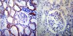 PSEN2 Antibody in Immunohistochemistry (Paraffin) (IHC (P))