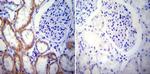 PSEN2 Antibody in Immunohistochemistry (Paraffin) (IHC (P))