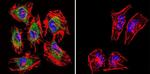 TIMP2 Antibody in Immunocytochemistry (ICC/IF)