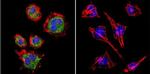 TIMP2 Antibody in Immunocytochemistry (ICC/IF)