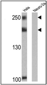 NCoR2 Antibody in Western Blot (WB)