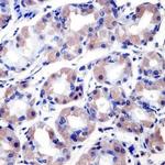 RANBP2 Antibody in Immunohistochemistry (Paraffin) (IHC (P))