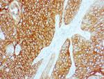 Cytokeratin 5/6 Antibody in Immunohistochemistry (Paraffin) (IHC (P))