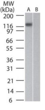 DNMT3A Antibody in Western Blot (WB)