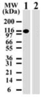 DNMT3A Antibody in Western Blot (WB)