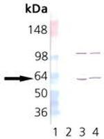 TCP1 Antibody in Western Blot (WB)