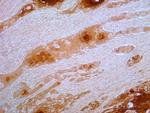 S100A7 Antibody in Immunohistochemistry (Paraffin) (IHC (P))