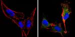 Recoverin Antibody in Immunocytochemistry (ICC/IF)