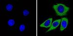 Recoverin Antibody in Immunocytochemistry (ICC/IF)