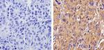 Recoverin Antibody in Immunohistochemistry (Paraffin) (IHC (P))