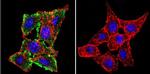 CFTR Antibody in Immunocytochemistry (ICC/IF)