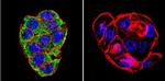 CFTR Antibody in Immunocytochemistry (ICC/IF)