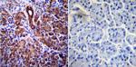 CFTR Antibody in Immunohistochemistry (Paraffin) (IHC (P))