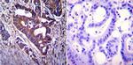 CFTR Antibody in Immunohistochemistry (Paraffin) (IHC (P))