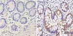 Galectin 3 Antibody in Immunohistochemistry (Paraffin) (IHC (P))