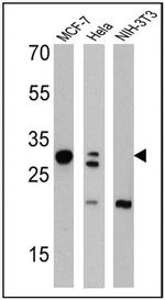 Galectin 3 Antibody in Western Blot (WB)