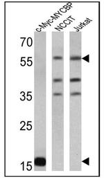 c-Myc Antibody in Western Blot (WB)