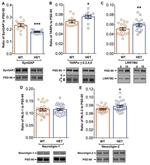 SynGAP Antibody in Western Blot (WB)