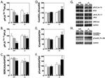 Phospho-CaMKII alpha (Thr286) Antibody in Western Blot (WB)