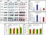 Phospho-CaMKII alpha (Thr286) Antibody in Western Blot (WB)