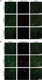 CaMKII alpha Antibody in Immunohistochemistry (IHC)