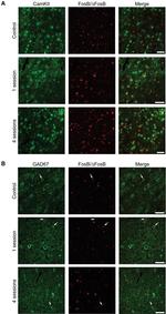 CaMKII alpha Antibody in Immunohistochemistry (IHC)