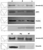 Arp3 Antibody in Western Blot (WB)