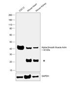 Alpha-Smooth Muscle Actin Antibody in Western Blot (WB)