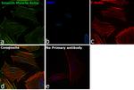 Alpha-Smooth Muscle Actin Antibody in Immunocytochemistry (ICC/IF)