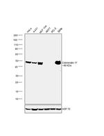 Cytokeratin 17 Antibody in Western Blot (WB)