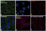 Cytokeratin 18 Antibody