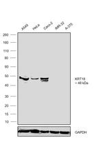 Cytokeratin 18 Antibody