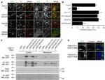 alpha Adaptin Antibody in Immunocytochemistry (ICC/IF)