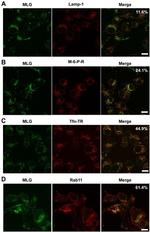 IGF2R Antibody in Immunocytochemistry (ICC/IF)