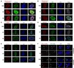 O-linked N-acetylglucosamine (O-GlcNAc) Antibody in Immunocytochemistry (ICC/IF)