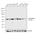 eIF2b gamma Antibody in Western Blot (WB)