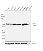 hnRNP K Antibody in Western Blot (WB)