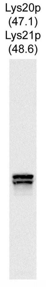 Lys20/Lys21 Antibody in Western Blot (WB)