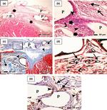 CD34 Antibody in Immunohistochemistry (IHC)