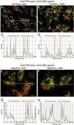 Factor VIII Antibody in Immunocytochemistry (ICC/IF)