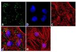 SOD2 Antibody in Immunocytochemistry (ICC/IF)