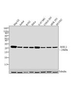 SOD2 Antibody in Western Blot (WB)