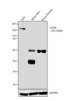 EGFR Antibody in Western Blot (WB)