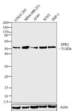 ZPR1 Antibody in Western Blot (WB)