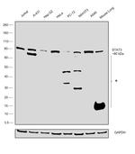 STAT3 Antibody in Western Blot (WB)