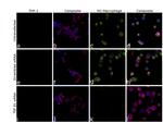 TGF beta-1 Antibody in Immunocytochemistry (ICC/IF)