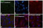 Cytokeratin 18 Antibody