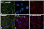 Cytokeratin 18 Antibody