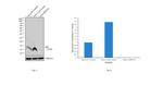 beta-2 Microglobulin Antibody in Western Blot (WB)